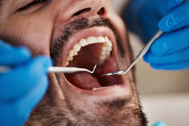 Best Urgent Dental Care for Toothache in Hamburg, NJ